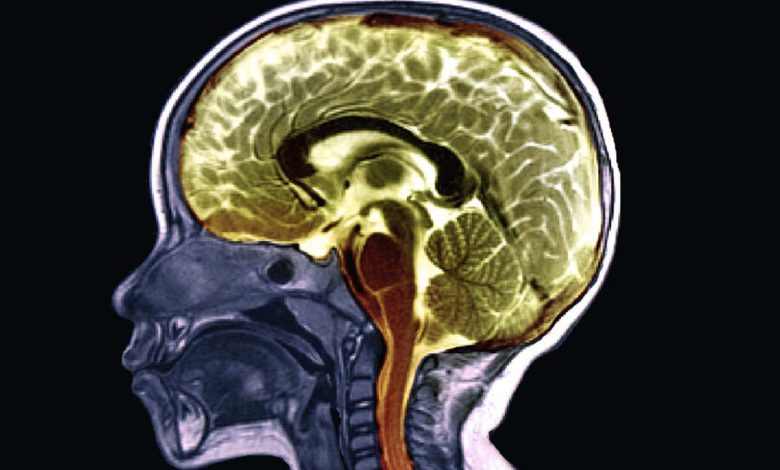 نقشه ای از تغییرات مغز ما با افزایش سن می تواند به تشخیص بیماری کمک کند