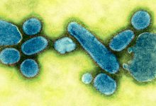 ویروس آنفولانزا: همه‌گیری مرگبار 1918 ممکن است منشأ آنفولانزای فصلی خفیف امروزی باشد.