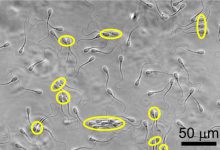 اسپرم ها در بسته هایی مانند دوچرخه سواران حرکت می کنند تا مایع غلیظ واژن را بیرون برانند