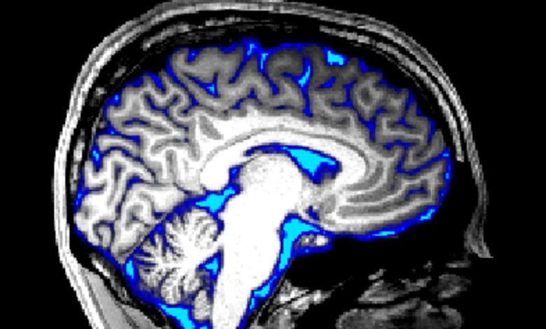سیستم گلیمفاتیک: مغز ممکن است پس از ورزش ذهنی از شر مواد زائد خلاص شود